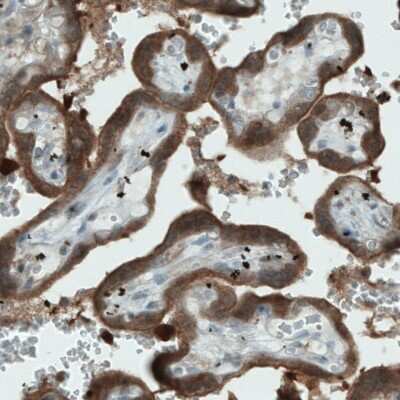 Immunohistochemistry-Paraffin: NAPRT1 Antibody (CL0665) [NBP2-52954] - Staining of human placenta shows strong immunoreactivity in the trophoblast.