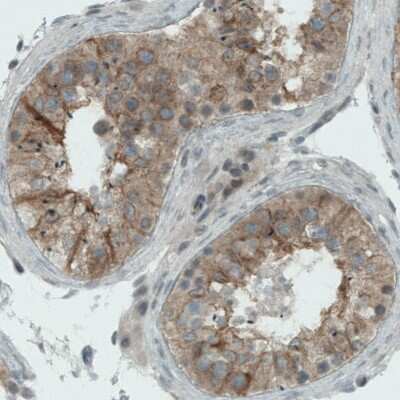 Immunohistochemistry-Paraffin: NAPRT1 Antibody (CL0665) [NBP2-52954] - Staining of human testis shows moderate cytoplasmic positivity in seminiferous tubules.