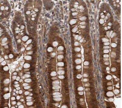 Immunohistochemistry-Paraffin: NAPRT1 Antibody [NBP1-87243] - Staining of human small intestine shows strong cytoplasmic positivity in glandular cells.