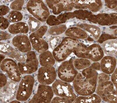 Immunohistochemistry-Paraffin: NAPRT1 Antibody [NBP1-87243] - Staining of human kidney shows strong cytoplasmic positivity in cells in tubules.