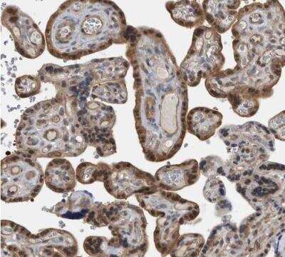 Immunohistochemistry-Paraffin: NAPRT1 Antibody [NBP1-87243] - Staining of human placenta shows strong cytoplasmic positivity in trophoblastic cells.