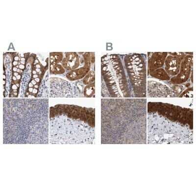 <b>Independent Antibodies Validation and Orthogonal Strategies Validation.</b>Immunohistochemistry-Paraffin: NAPRT1 Antibody [NBP1-87244] - Staining of human colon, kidney, lymph node and urinary bladder using Anti-NAPRT antibody NBP1-87244 (A) shows similar protein distribution across tissues to independent antibody NBP1-87243 (B).