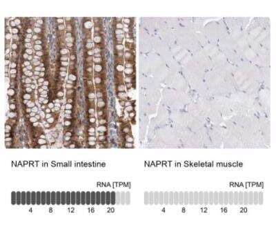 Immunohistochemistry-Paraffin NAPRT1 Antibody