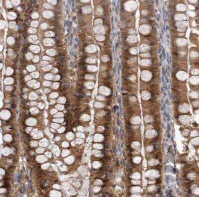 Immunohistochemistry-Paraffin: NAPRT1 Antibody [NBP1-87244] - Staining of human small intestine shows strong cytoplasmic positivity in glandular cells.