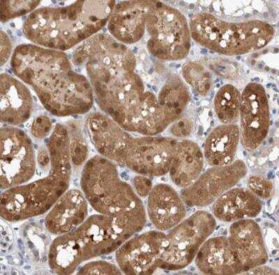 Immunohistochemistry-Paraffin: NAPRT1 Antibody [NBP1-87244] - Staining of human kidney shows strong cytoplasmic positivity in cells in tubules.