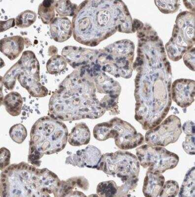 Immunohistochemistry-Paraffin: NAPRT1 Antibody [NBP1-87244] - Staining of human placenta shows moderate cytoplasmic positivity in tropoblastic cells.