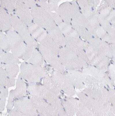 Immunohistochemistry-Paraffin: NAPRT1 Antibody [NBP1-87244] - Staining of human skeletal muscle shows no positivity in myocytes as expected.