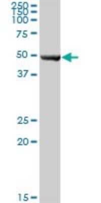 Western Blot: NAPRT1 Antibody [H00093100-B01P] - Analysis of NAPRT1 expression in human liver.