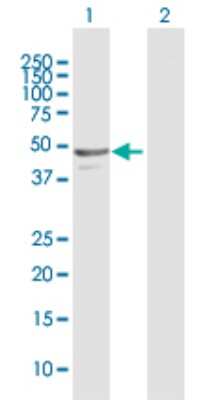 Western Blot: NAPRT1 Antibody [H00093100-D01P] - Analysis of NAPRT1 expression in transfected 293T cell line by NAPRT1 polyclonal antibody.Lane 1: NAPRT1 transfected lysate(49.60 KDa).Lane 2: Non-transfected lysate.