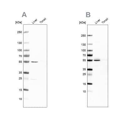 <b>Independent Antibodies Validation. </b>Western Blot: NAPRT1 Antibody [NBP1-87244] - Analysis using Anti-NAPRT antibody NBP1-87244 (A) shows similar pattern to independent antibody NBP1-87243 (B).