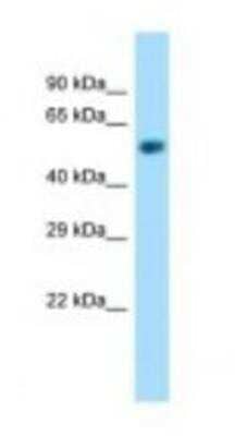 Western Blot: NAPRT1 Antibody [NBP1-98433] - Mouse Kidney Lysate 1.0ug/ml, Gel Concentration: 12%