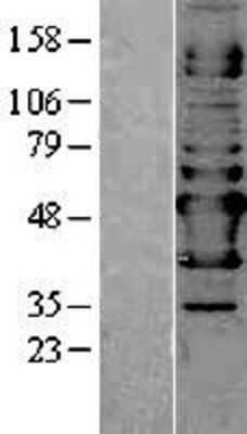 Western Blot NAPRT1 Overexpression Lysate