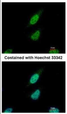 Immunocytochemistry/Immunofluorescence: NARF Antibody [NBP2-19475] - IF analysis of paraformaldehyde-fixed HeLa cells, using NARF antibody at 1:500.