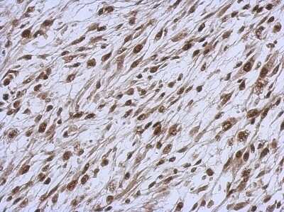 Immunohistochemistry-Paraffin: NARF Antibody [NBP2-19474] - C2C12 xenograft, using NARF antibody at 1:500 dilution.  Antigen Retrieval: Trilogy™ (EDTA based, pH 8.0) buffer, 15min