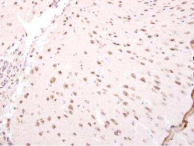 Immunohistochemistry-Paraffin: NARF Antibody [NBP2-19475] - Paraffin-embedded mouse forebrain section. NARF antibody at 1:250.