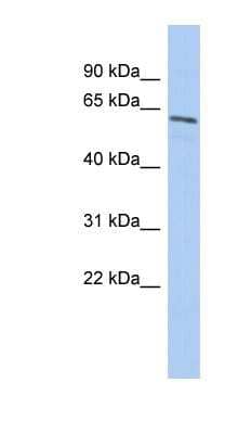 Western Blot: NARF Antibody [NBP1-54360] - Human Spleen lysate, concentration 0.2-1 ug/ml.