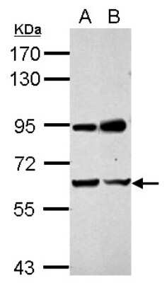 Western Blot: NARF Antibody [NBP2-19475] - Sample (30 ug of whole cell lysate) A: A549 B: MCF-7 7. 5% SDS PAGE gel, NARF antibody at 1:1000.