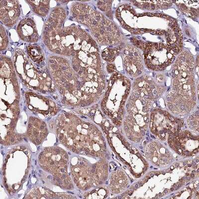 Immunohistochemistry-Paraffin: NARFL Antibody [NBP1-83611] - Staining of human kidney shows strong cytoplasmic positivity in distal tubules.