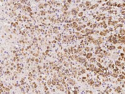 Immunohistochemistry-Paraffin: NARFL Antibody [NBP3-06258] - Immunochemical staining of human NARFL in human adrenal gland with rabbit polyclonal antibody at 1:100 dilution, formalin-fixed paraffin embedded sections.