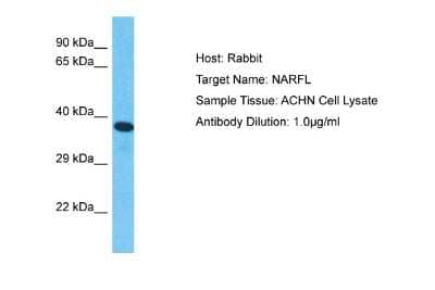 Western Blot: NARFL Antibody [NBP2-85357] - Host: Rabbit. Target Name: NARFL. Sample Type: ACHN Whole Cell lysates. Antibody Dilution: 1.0ug/ml