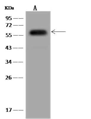 Western Blot: NARFL Antibody [NBP3-06258] - Anti-NARFL rabbit polyclonal antibody at 1:500 dilution.