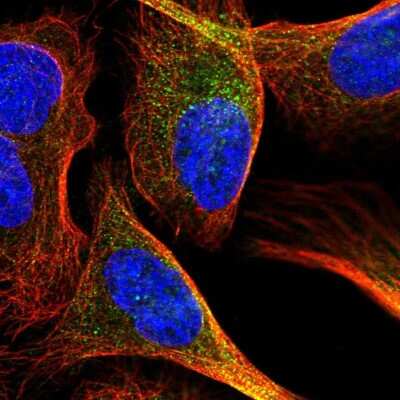 Immunocytochemistry/Immunofluorescence: NARG1 Antibody [NBP2-58078] - Staining of human cell line U-2 OS shows localization to cytosol.