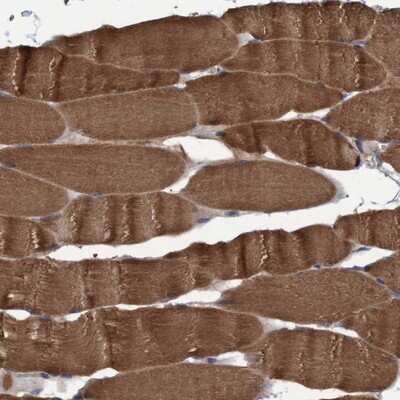 Immunohistochemistry-Paraffin: NARG1 Antibody [NBP1-92165] - Staining of human skeletal muscle shows cytoplasmic positivity in myocytes.