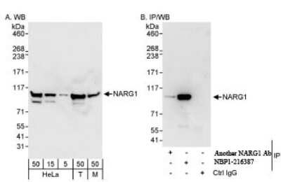 Western Blot: NARG1 Antibody [NBP1-21387] - Whole cell lysate from HeLa (5, 15 and 50 mcg for WB; 1 mg for IP, 20% of IP loaded), 293T (T; 50 mcg) and mouse NIH3T3 (M; 50mcg) cells. NBP1-21387 used for WB at 0.04 mcg/ml (A) and 1 mcg/ml (B) and used for IP at 3 mcg/mg lysate.