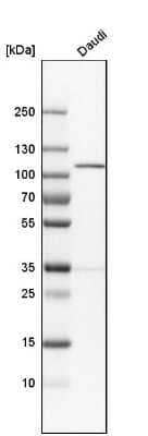 Western Blot: NARG1 Antibody [NBP1-92165] - Analysis in human cell line Daudi.