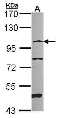 Western Blot: NARG1 Antibody [NBP2-19477] - Sample (30 ug of whole cell lysate) A: 293T 7. 5% SDS PAGE gel, diluted at 1:1000.