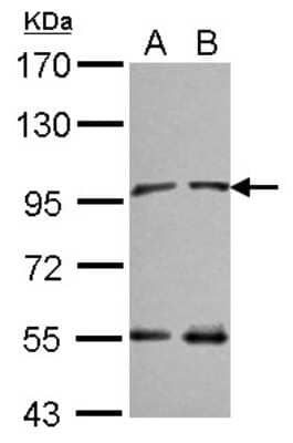 Western Blot: NARG1 Antibody [NBP2-19478] - Sample (30 ug of whole cell lysate) A: NT2D1 B: IMR32 7. 5% SDS PAGE gel, diluted at 1:10000.