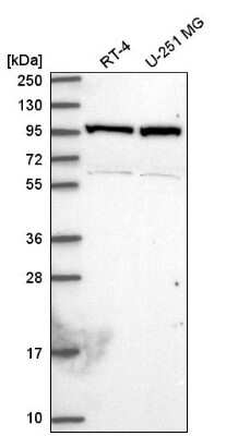 Western Blot: NARG1 Antibody [NBP2-58078] - Western blot analysis in human cell line RT-4 and human cell line U-251 MG.