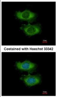 Immunocytochemistry/Immunofluorescence: NARG1L Antibody [NBP2-19479] - Immunofluorescence analysis of methanol-fixed HeLa, using antibody at 1:200 dilution.