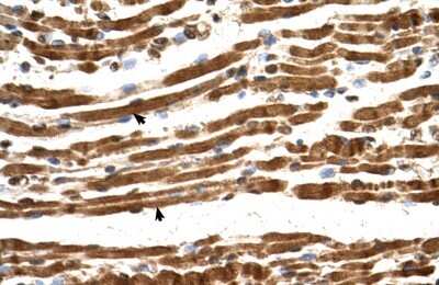 Immunohistochemistry-Paraffin: NARG1L Antibody [NBP1-53124] - Human Muscle Tissue, Skeletal muscle cells (Indicated with Arrows) 4-8ug/ml.