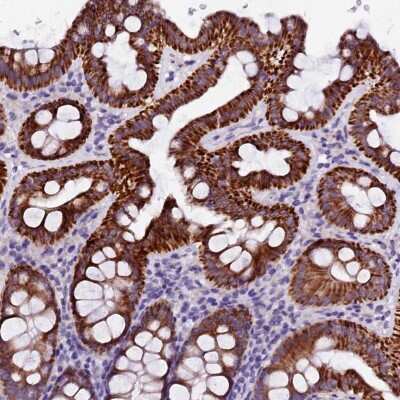 Immunohistochemistry-Paraffin: NARG1L Antibody [NBP1-92166] - Staining of human colon shows strong cytoplasmic positivity in glandular cells.