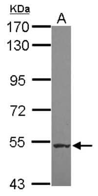 Western Blot: NARG1L Antibody [NBP2-19479] - Sample (30 ug of whole cell lysate) A: HepG2 7. 5% SDS PAGE gel, diluted at 1:3000.