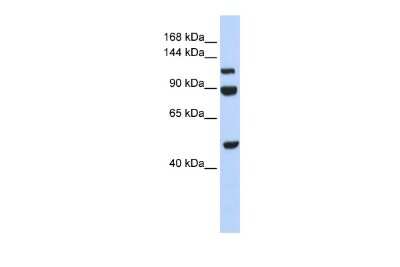 Western Blot: NARG1L Antibody [NBP3-09263] - Western blot analysis using NBP3-09263 on Human 293T as a positive control. Antibody Titration: 0.2-1 ug/ml