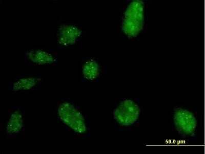 Immunocytochemistry/ Immunofluorescence NARG2 Antibody