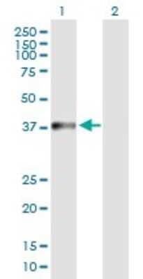 Western Blot NARG2 Antibody