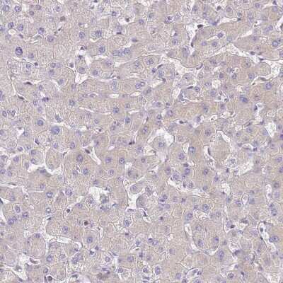 Immunohistochemistry-Paraffin: NARS Antibody [NBP2-13640] - Staining of human liver shows very weak cytoplasmic positivity in hepatocytes.