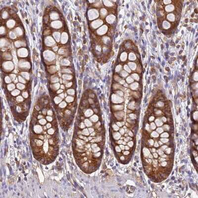 Immunohistochemistry-Paraffin: NARS Antibody [NBP2-13640] - Staining of human rectum shows moderate cytoplasmic positivity in glandular cells.