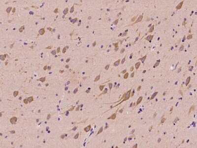 Immunohistochemistry-Paraffin: NARS Antibody [NBP2-98529] - Immunochemical staining of human NARS in human brain with rabbit polyclonal antibody at 1:500 dilution, formalin-fixed paraffin embedded sections.