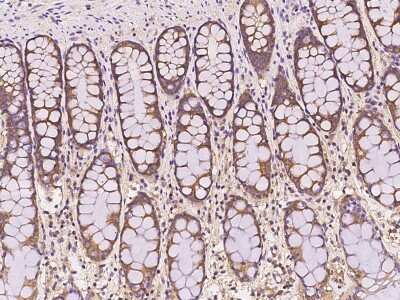 Immunohistochemistry-Paraffin: NARS Antibody [NBP2-98529] - Immunochemical staining of human NARS in human rectum with rabbit polyclonal antibody at 1:500 dilution, formalin-fixed paraffin embedded sections.