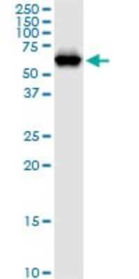 Western Blot: NARS Antibody [H00004677-B01P] - Analysis of NARS expression in Jurkat.