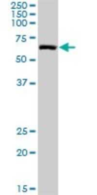 Western Blot: NARS Antibody [H00004677-D01P] - Analysis of NARS expression in mouse spleen.