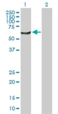 Western Blot: NARS Antibody [H00004677-D01P] - Analysis of NARS expression in transfected 293T cell line by NARS polyclonal antibody.Lane 1: NARS transfected lysate(62.90 KDa).Lane 2: Non-transfected lysate.