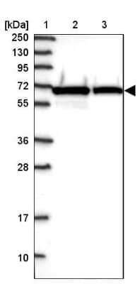 Western Blot: NARS Antibody [NBP2-13640] - Lane 1: Marker  [kDa] 250, 130, 95, 72, 55, 36, 28, 17, 10.  Lane 2: Human cell line RT-4.  Lane 3: Human cell line U-251MG sp