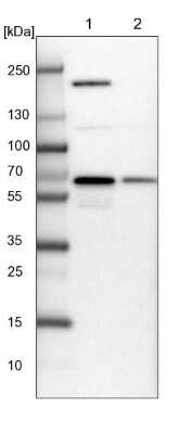 Western Blot: NARS Antibody [NBP2-13640] - Lane 1: NIH-3T3 cell lysate (Mouse embryonic fibroblast cells). Lane 2: NBT-II cell lysate (Rat Wistar bladder tumor cells).