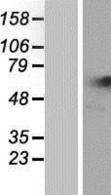 Western Blot: NARS Overexpression Lysate (Adult Normal) [NBP2-07864] Left-Empty vector transfected control cell lysate (HEK293 cell lysate); Right -Over-expression Lysate for NARS.