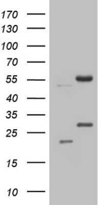Western Blot: NARS2 Antibody (OTI10C10) - Azide and BSA Free [NBP2-72876] - Analysis of HEK293T cells were transfected with the pCMV6-ENTRY control (Left lane) or pCMV6-ENTRY NARS2.